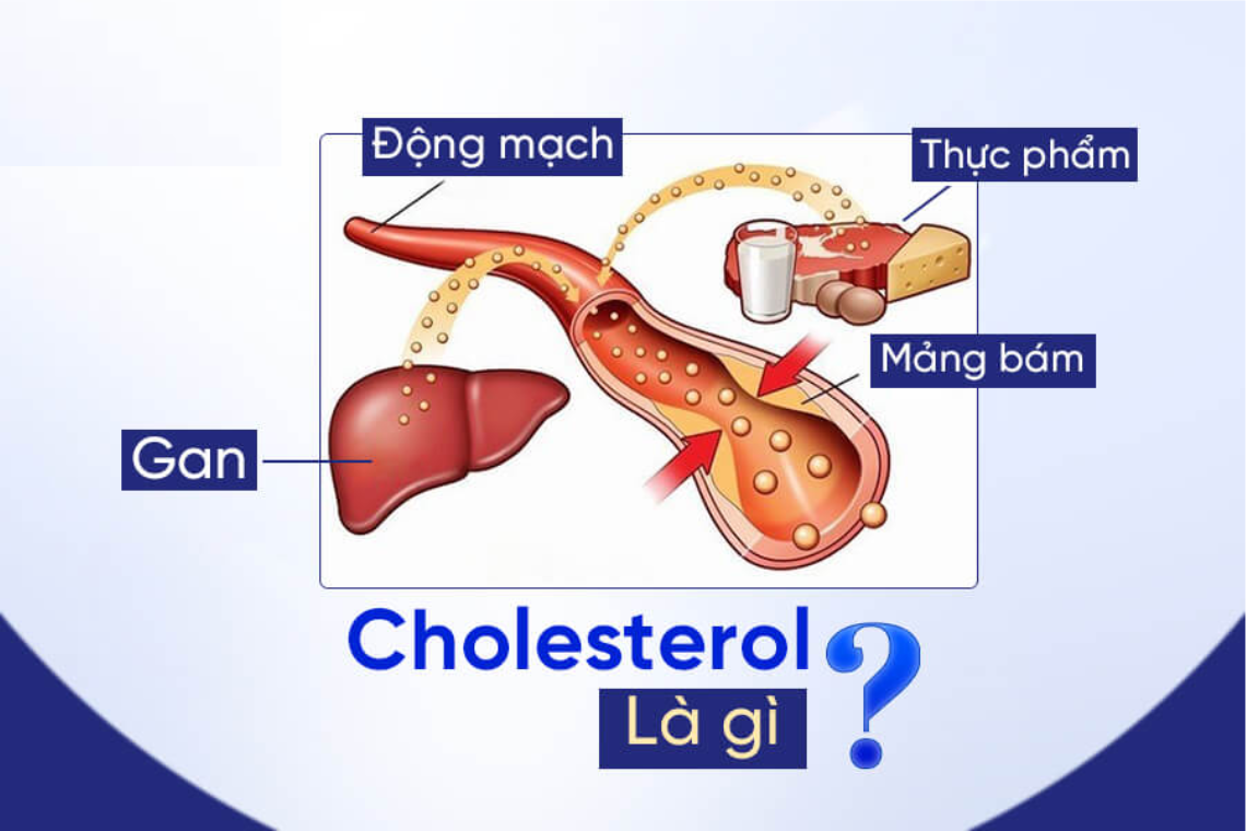  cholesterol công thức